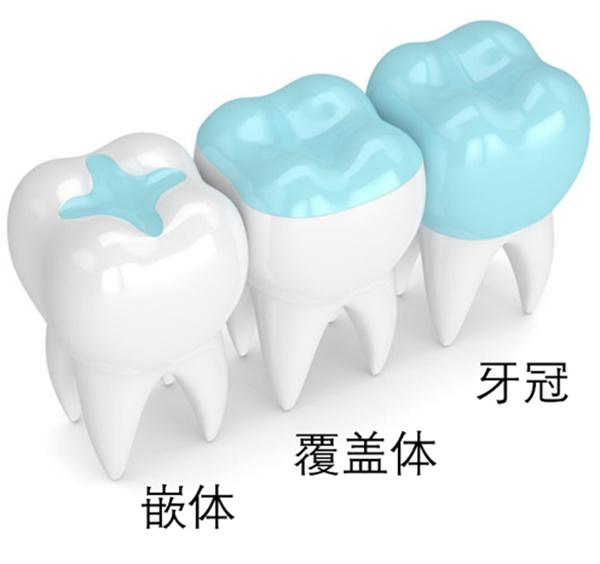图片 70.jpg